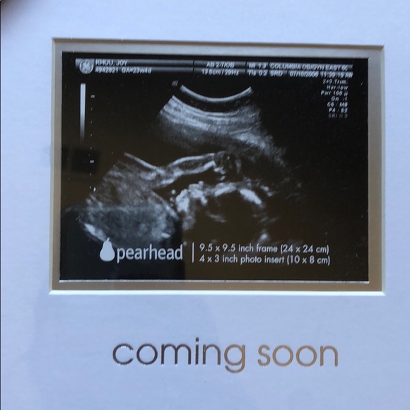 Sonogram Frame - Picture 3 of 4